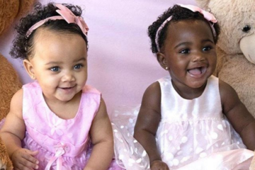 Тие се неодоливи: Запознајте ги близначките со различна боја на кожата