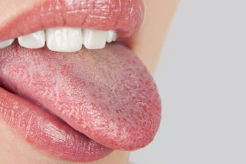 Состојби кои предизвикуваат метален вкус во устата